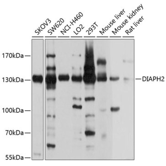 DIAPH2 Rabbit Polyclonal Antibody