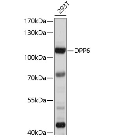 DPP6 Rabbit Polyclonal Antibody