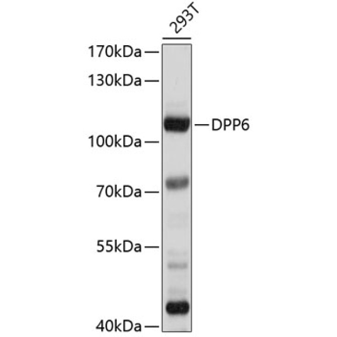 DPP6 Rabbit Polyclonal Antibody