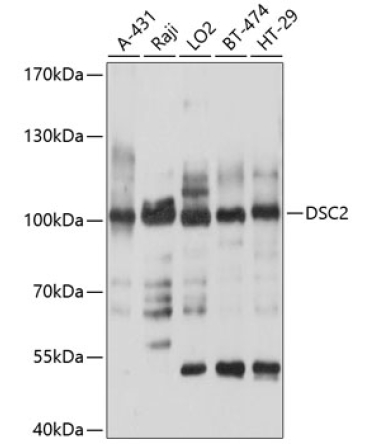 DSC2 Rabbit Polyclonal Antibody