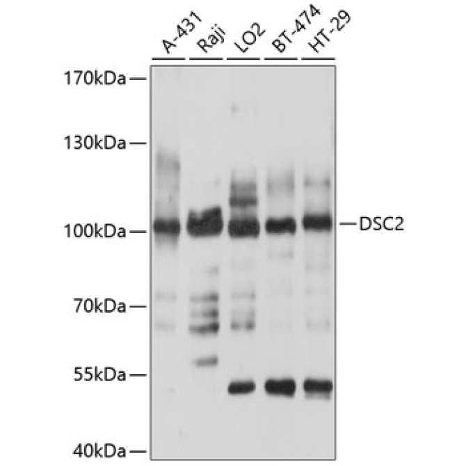 DSC2 Rabbit Polyclonal Antibody