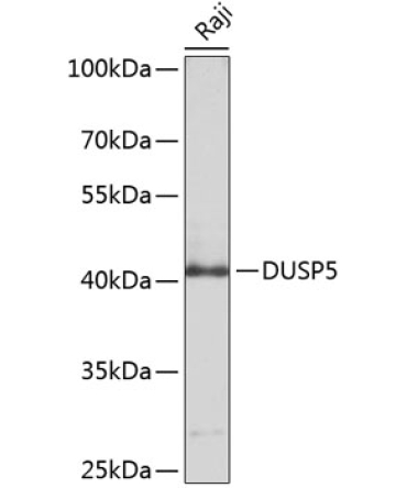 DUSP5 Rabbit Polyclonal Antibody