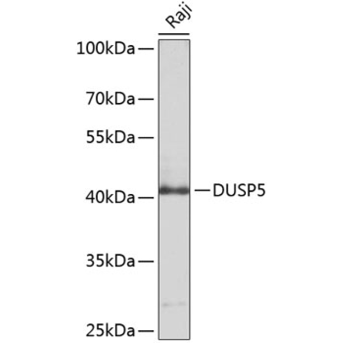 DUSP5 Rabbit Polyclonal Antibody
