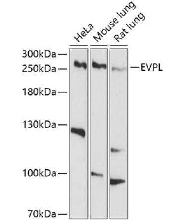 EVPL Rabbit Polyclonal Antibody