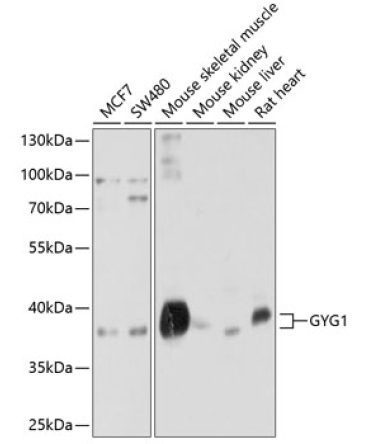 GYG1 Rabbit Polyclonal Antibody