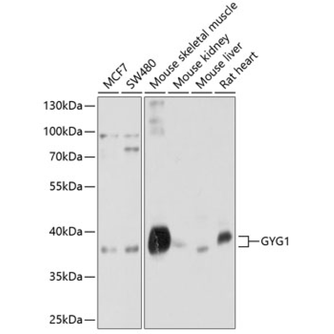 GYG1 Rabbit Polyclonal Antibody