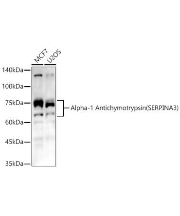 Alpha-1 Antichymotrypsin (SERPINA3) Rabbit Polyclonal Antibody