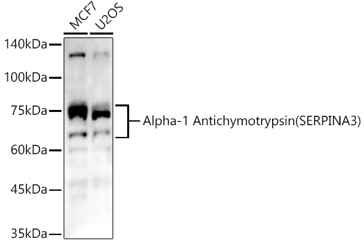 Alpha-1 Antichymotrypsin (SERPINA3) Rabbit Polyclonal Antibody