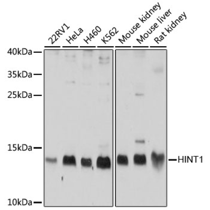 HINT1 Rabbit Polyclonal Antibody