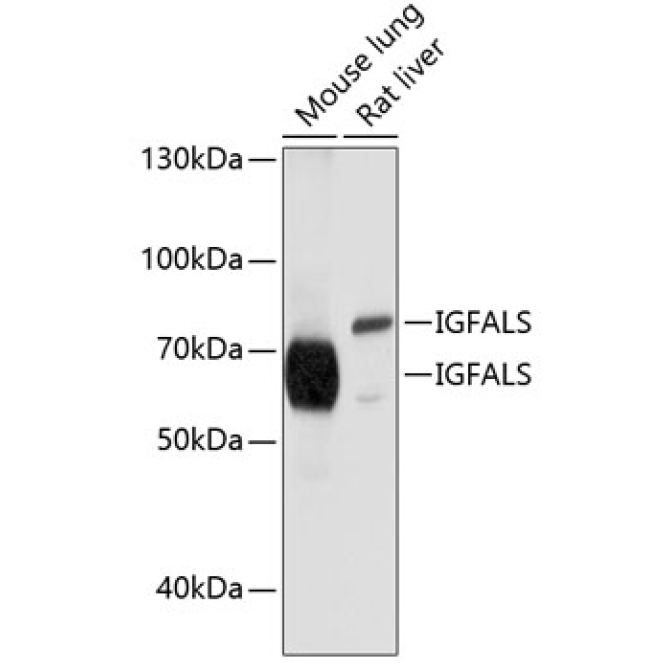 IGFALS Rabbit Polyclonal Antibody