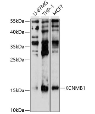 KCNMB1 Rabbit Polyclonal Antibody