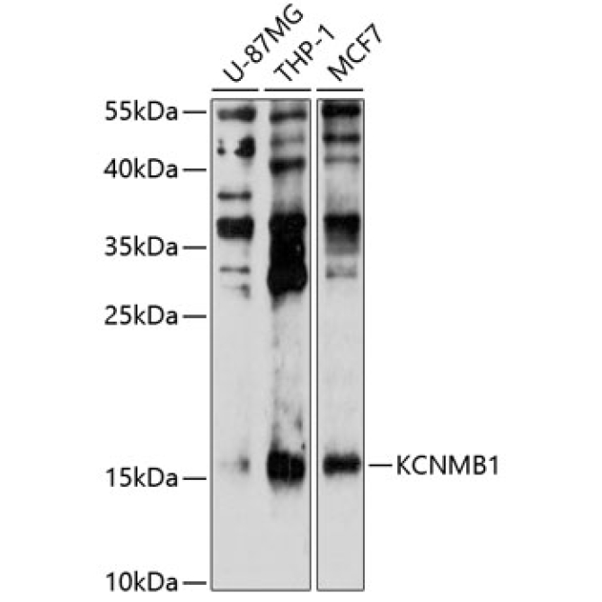 KCNMB1 Rabbit Polyclonal Antibody