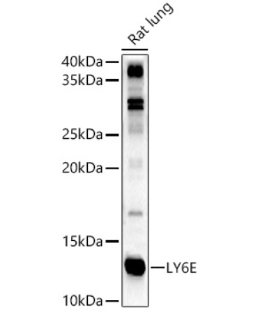 LY6E Rabbit Polyclonal Antibody