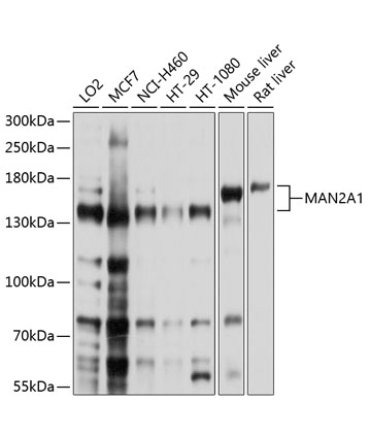 MAN2A1 Rabbit Polyclonal Antibody