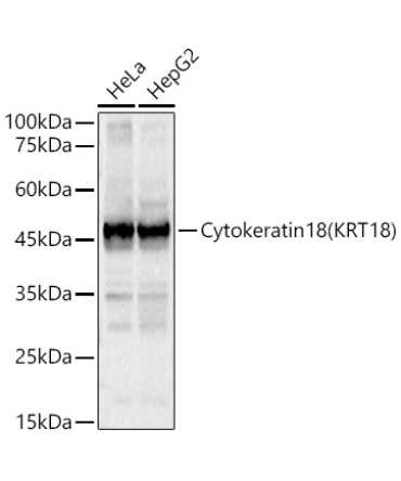 Cytokeratin 18 (KRT18) Rabbit Polyclonal Antibody
