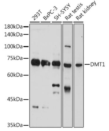 DMT1/SLC11A2 Rabbit Polyclonal Antibody