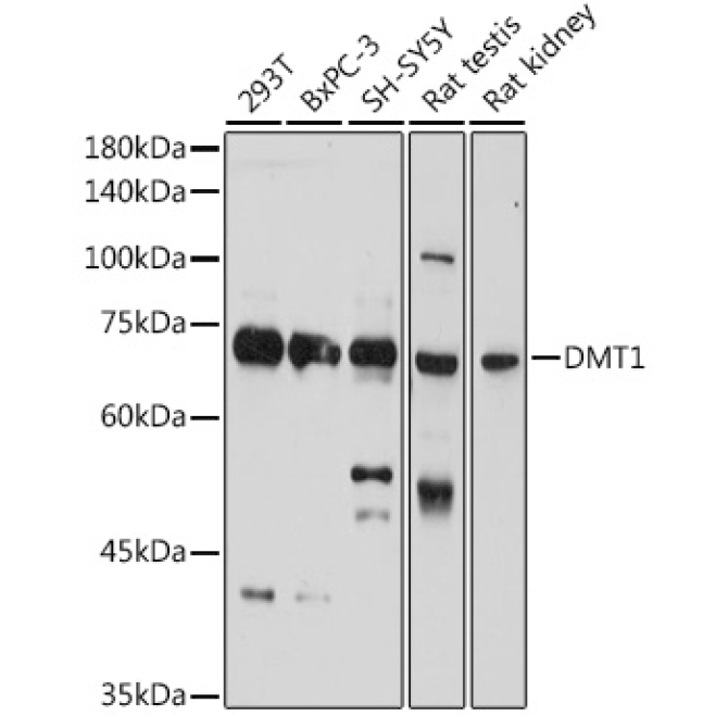 DMT1/SLC11A2 Rabbit Polyclonal Antibody