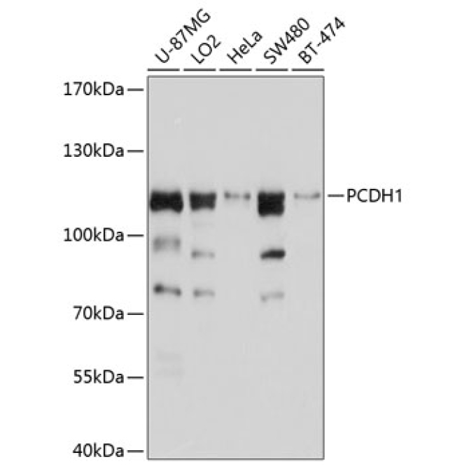 PCDH1 Rabbit Polyclonal Antibody