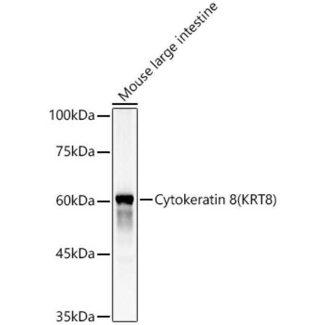 Cytokeratin 8 (KRT8) Rabbit Polyclonal Antibody
