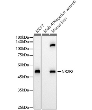 NR2F2 Rabbit Polyclonal Antibody