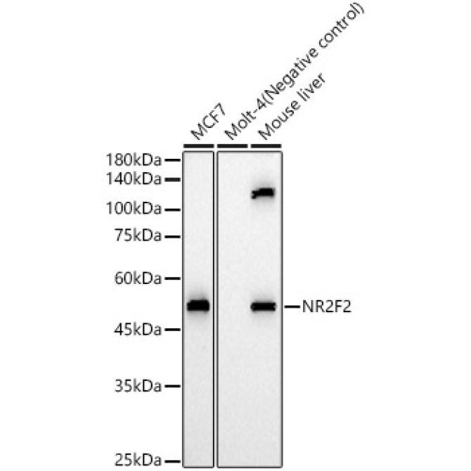 NR2F2 Rabbit Polyclonal Antibody