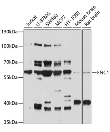 ENC1 Rabbit Polyclonal Antibody