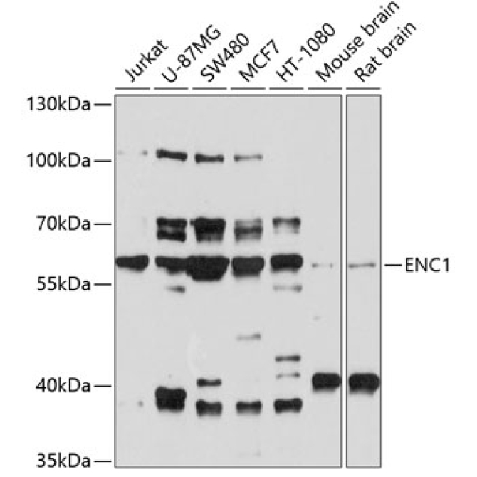 ENC1 Rabbit Polyclonal Antibody