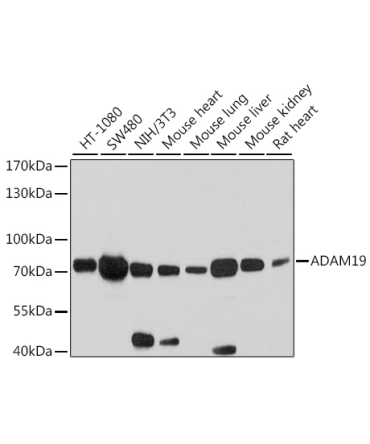 ADAM19 Rabbit Polyclonal Antibody