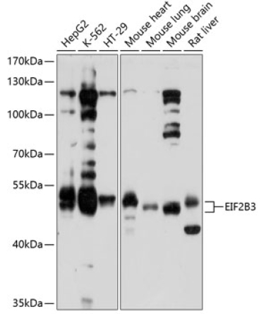 EIF2B3 Rabbit Polyclonal Antibody