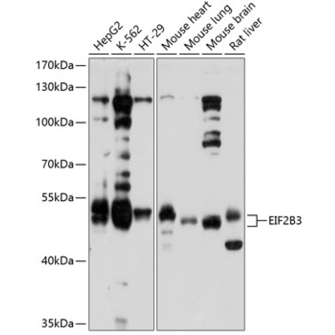EIF2B3 Rabbit Polyclonal Antibody