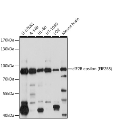 eIF2B epsilon (EIF2B5) Rabbit Polyclonal Antibody