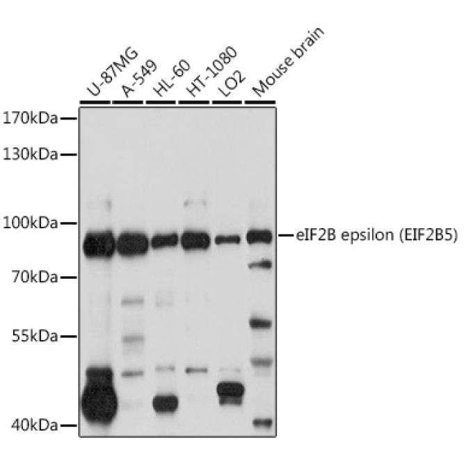 eIF2B epsilon (EIF2B5) Rabbit Polyclonal Antibody
