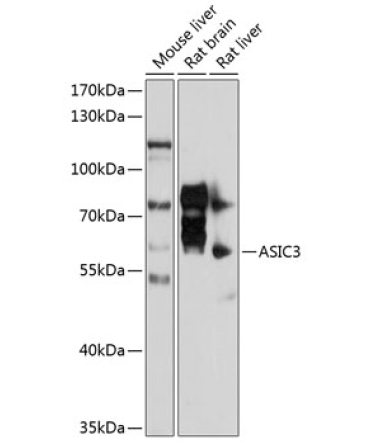 ASIC3 Rabbit Polyclonal Antibody