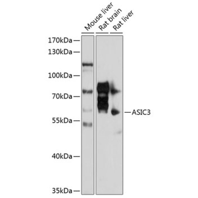 ASIC3 Rabbit Polyclonal Antibody