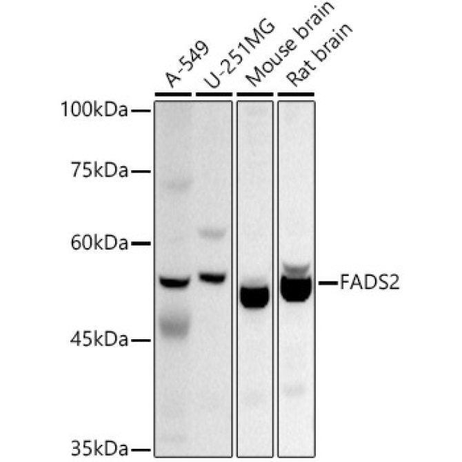 FADS2 Rabbit Polyclonal Antibody