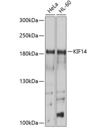 KIF14 Rabbit Polyclonal Antibody