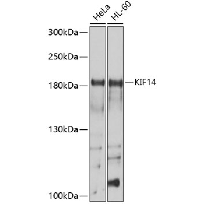 KIF14 Rabbit Polyclonal Antibody