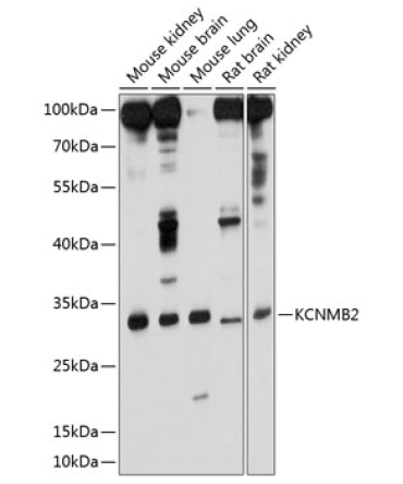 KCNMB2 Rabbit Polyclonal Antibody