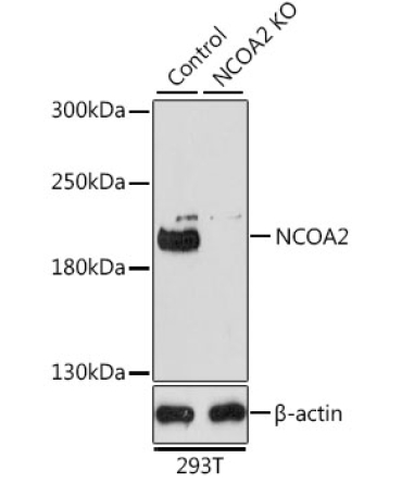 NCOA2 Rabbit Polyclonal Antibody [KO Validated]