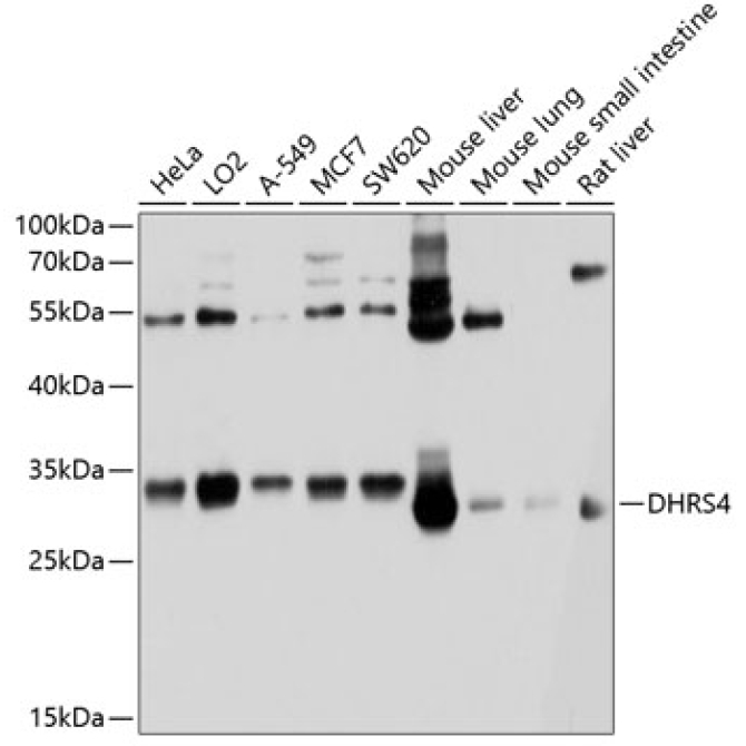 DHRS4 Rabbit Polyclonal Antibody