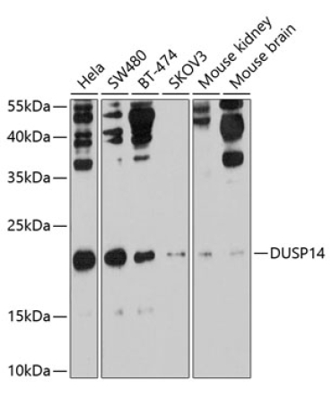 DUSP14 Rabbit Polyclonal Antibody