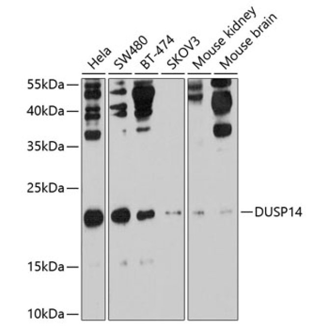DUSP14 Rabbit Polyclonal Antibody