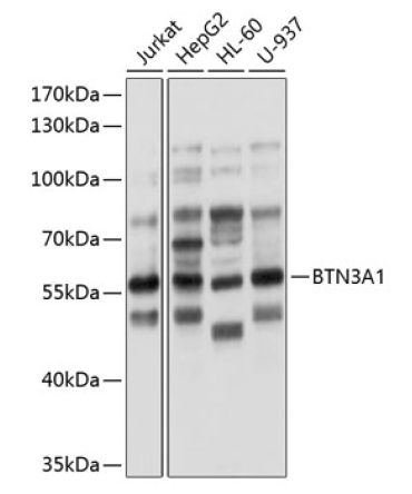 BTN3A1 Rabbit Polyclonal Antibody