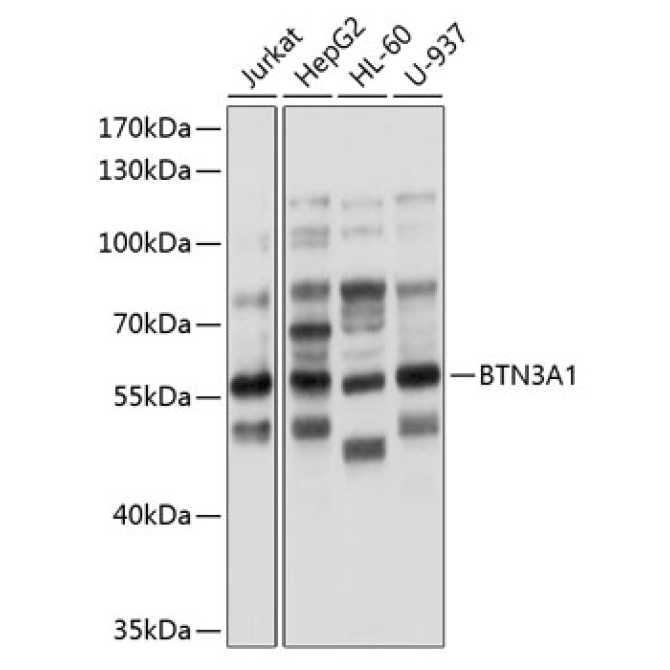 BTN3A1 Rabbit Polyclonal Antibody
