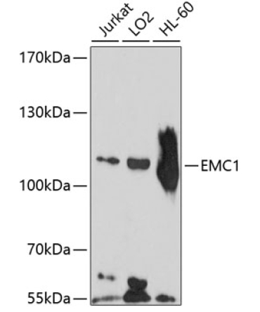 EMC1 Rabbit Polyclonal Antibody