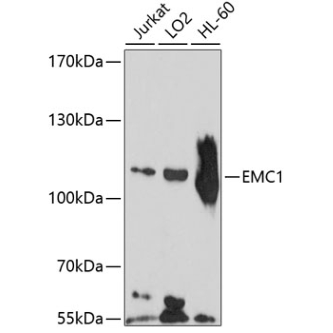 EMC1 Rabbit Polyclonal Antibody