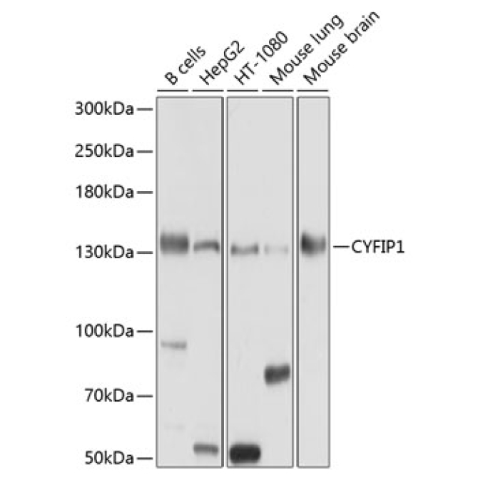 CYFIP1 Rabbit Polyclonal Antibody
