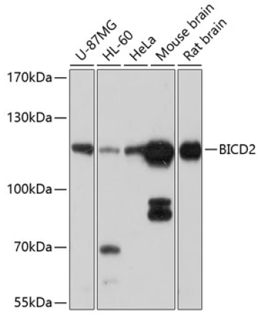 BICD2 Rabbit Polyclonal Antibody