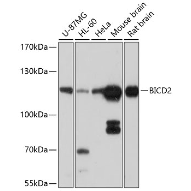 BICD2 Rabbit Polyclonal Antibody