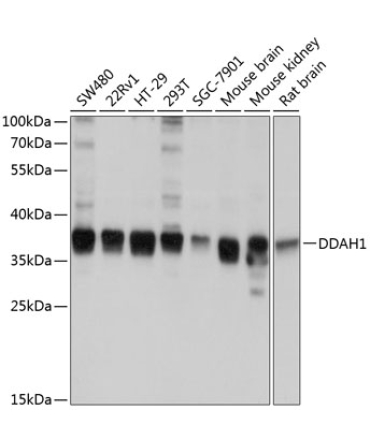 DDAH1 Rabbit Polyclonal Antibody